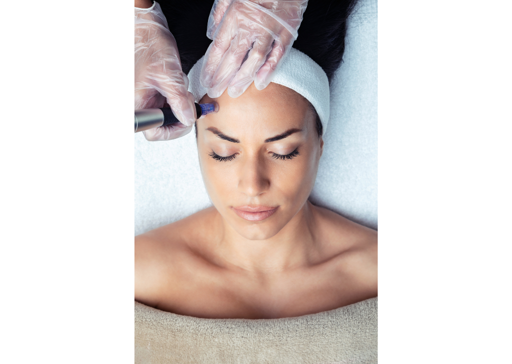 Microneedling behandelingen met Dermapen 4