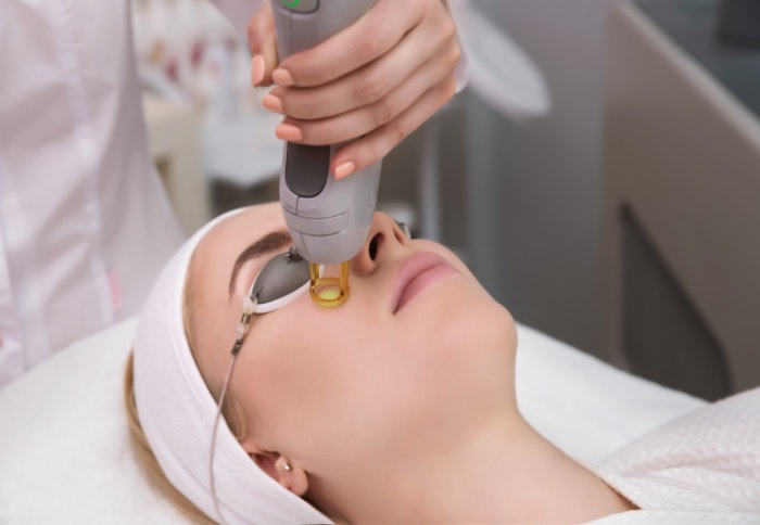 Gelaast laser ontharen